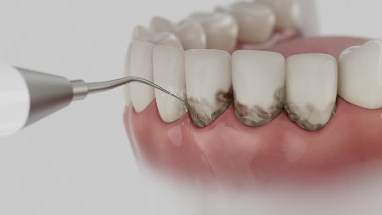 Reliable Dental Implants contractor in Depew, NY by Smile Center Dentistry